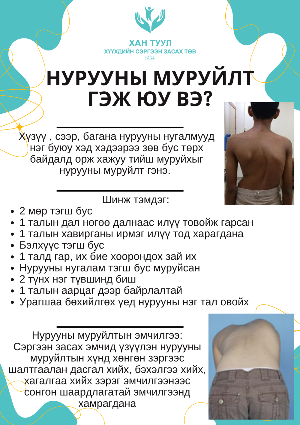Нурууны муруйлт гэж юу вэ?