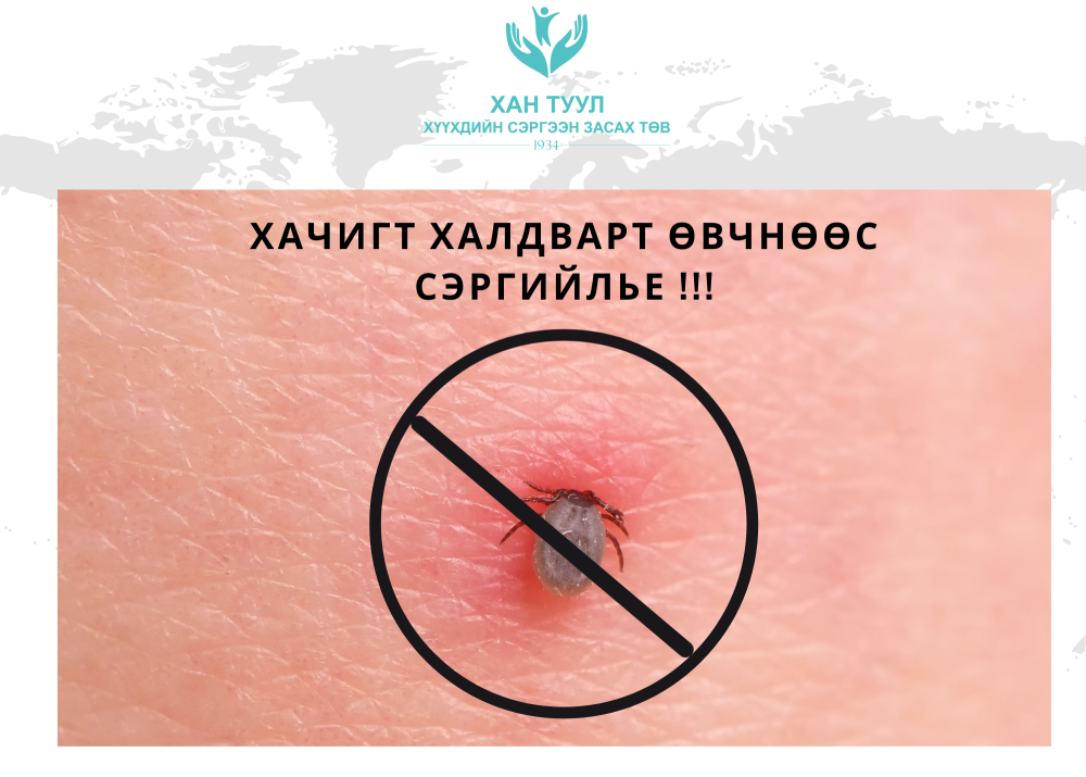 Хачигт халдварт өвчнөөс сэргийлье
